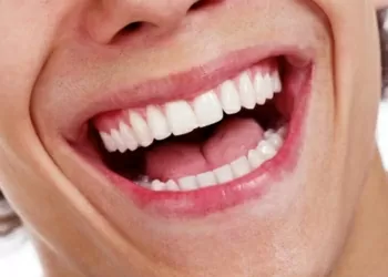 man with open mouth smiling